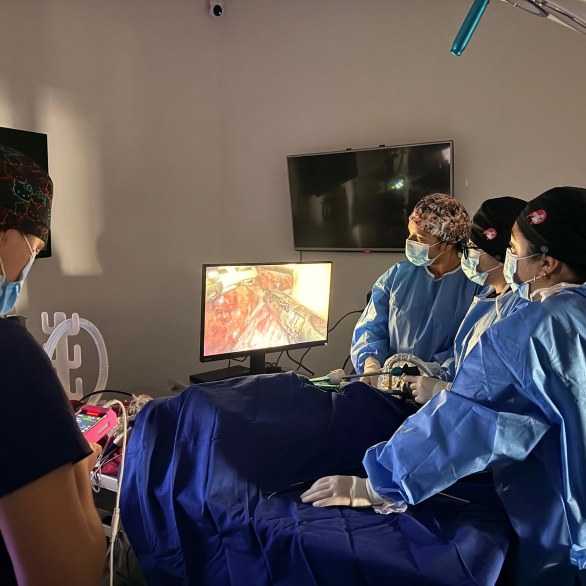 Cirugía laparoscópica con cuatro profesionales frente al monitor